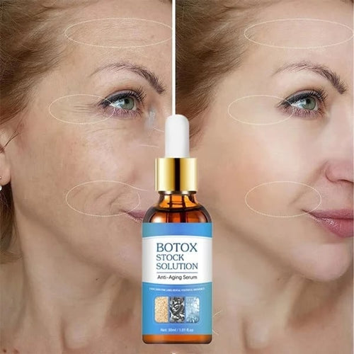 Last Day Promotion 70% OFF - đ„Botox Face Serum