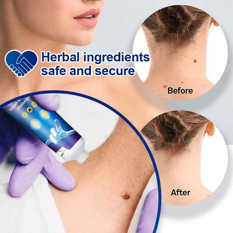 WartsOff Instant Blemish Removal Cream