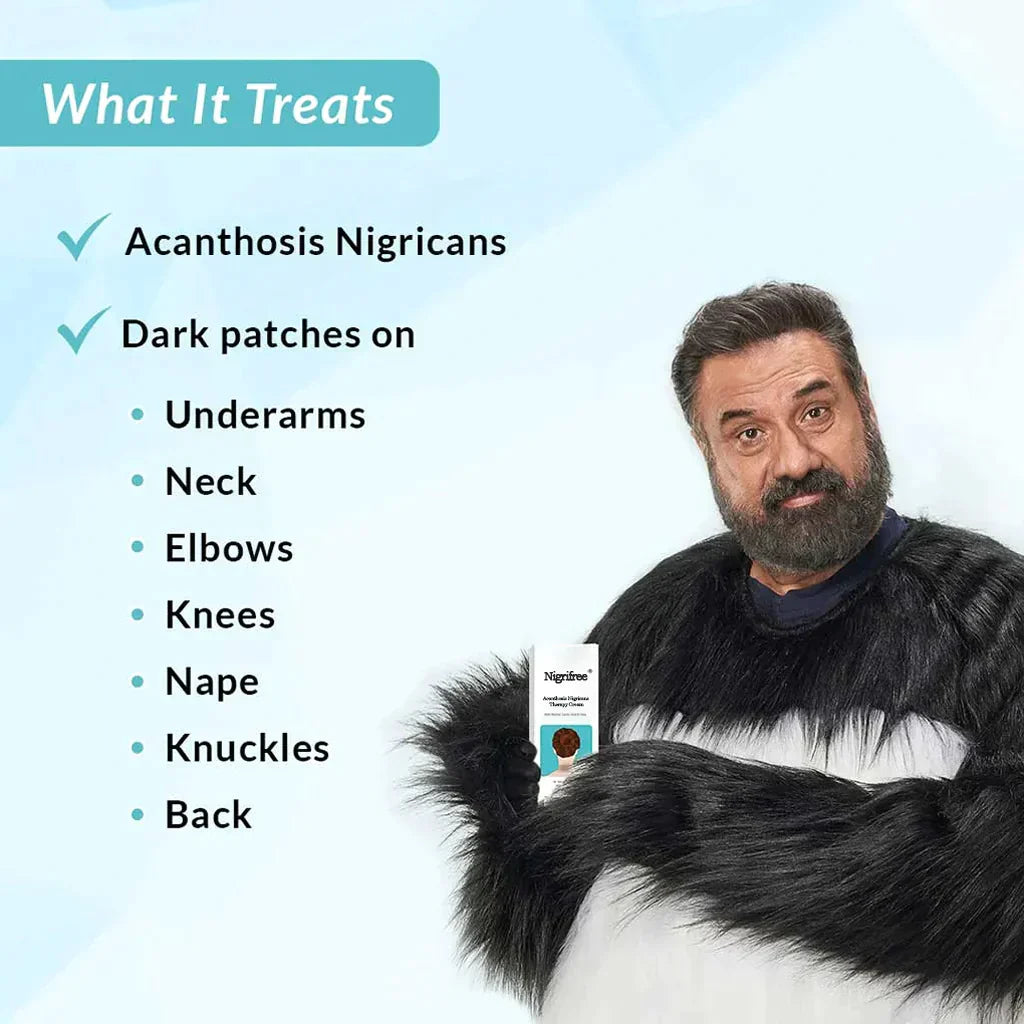 Nigrifree® Acanthosis Nigricans Therapy Cream - - 10% Lactic Acid + 0.1% Retinol