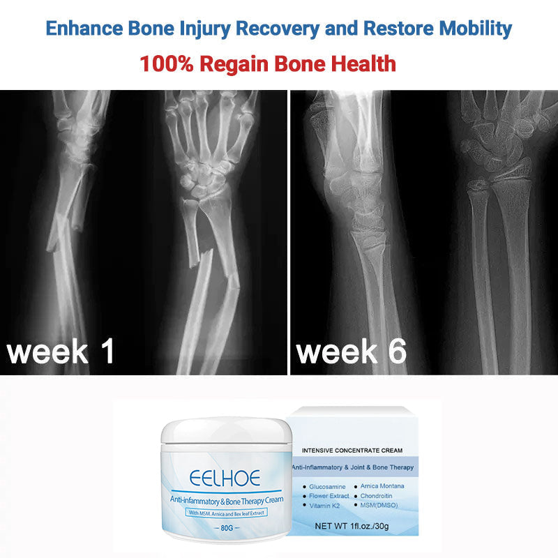 EELHOE™ Anti-Inflammatory & Joint & Bone Therapy Cream