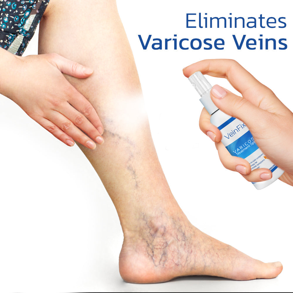 FixVein Varicose Treatment Spray