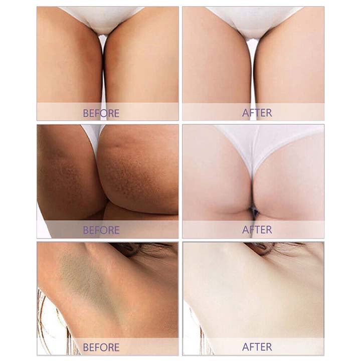 BioLap™ Dark Spot Correcting Cream