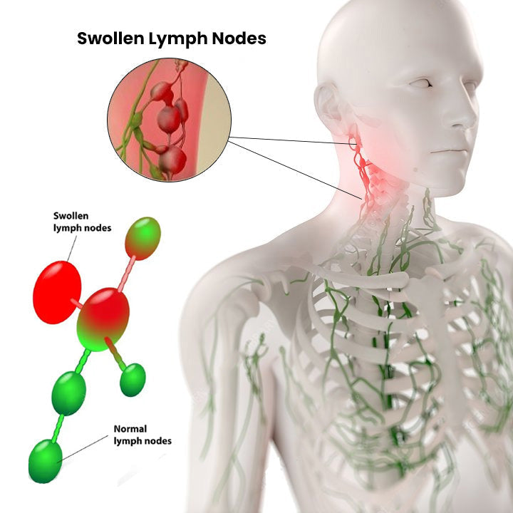 Lymph Nodes Herbal Detox Patch