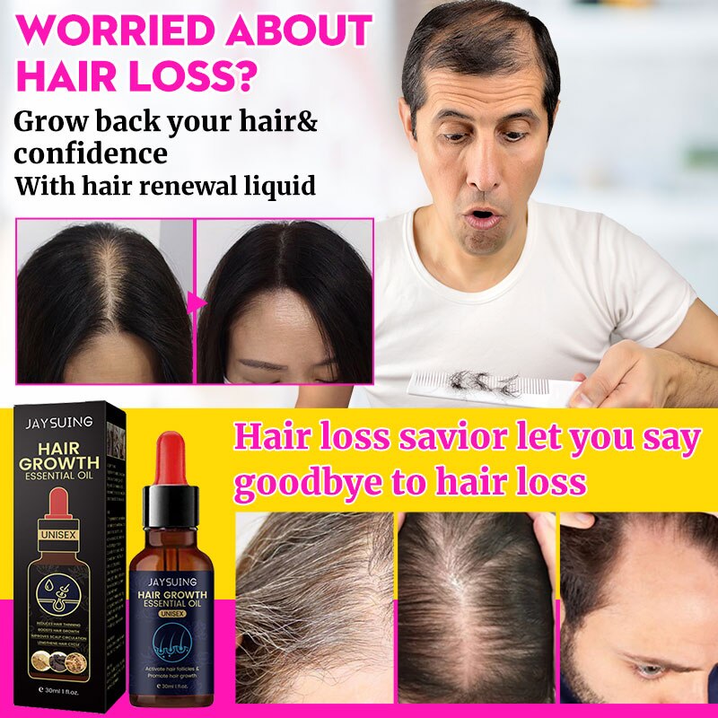 JAYSUING™ Hair Growth Oil Fast Hair Growth Effective Treatment