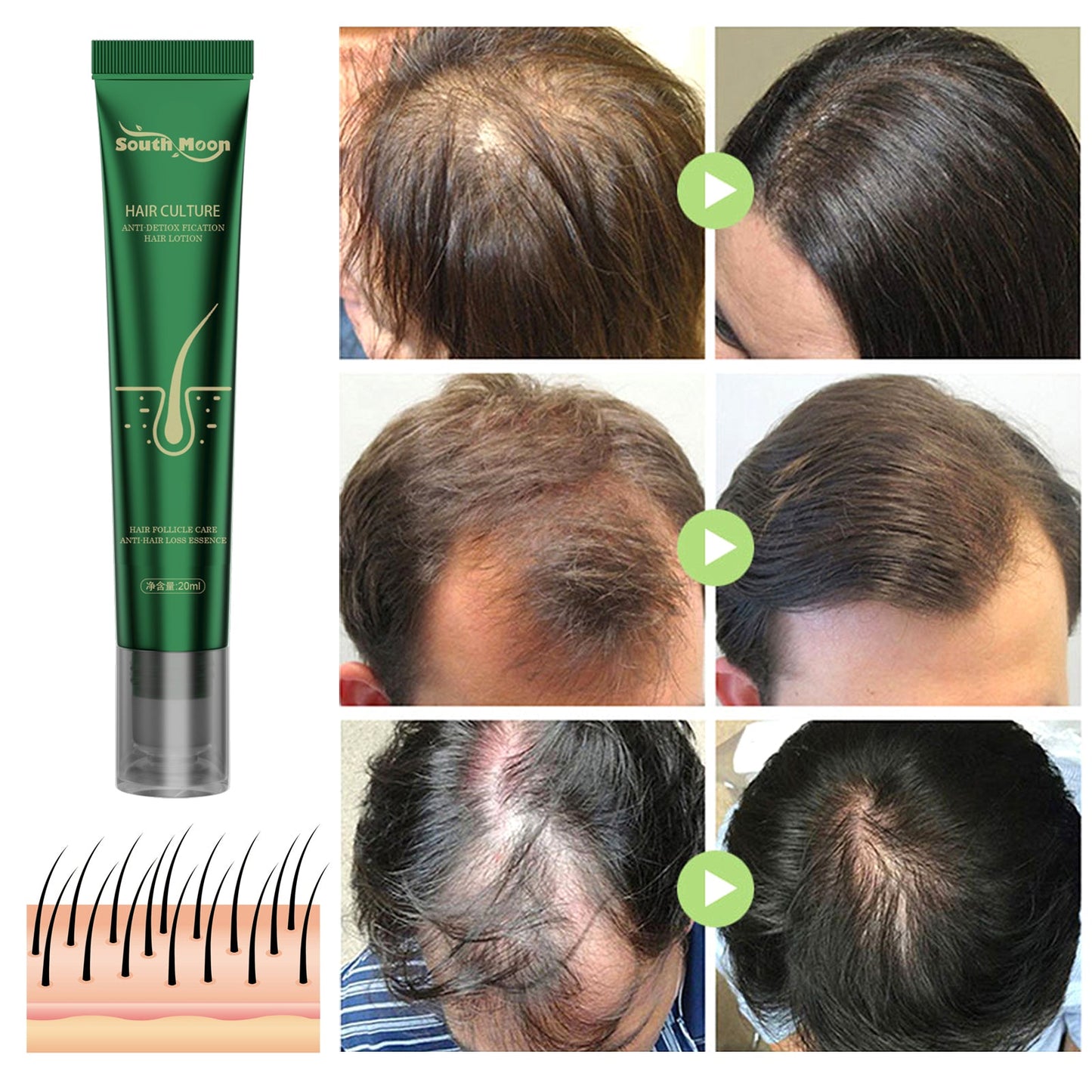 South Moon™ 2023 Biotin Fast Hair Growth Oil Unisex