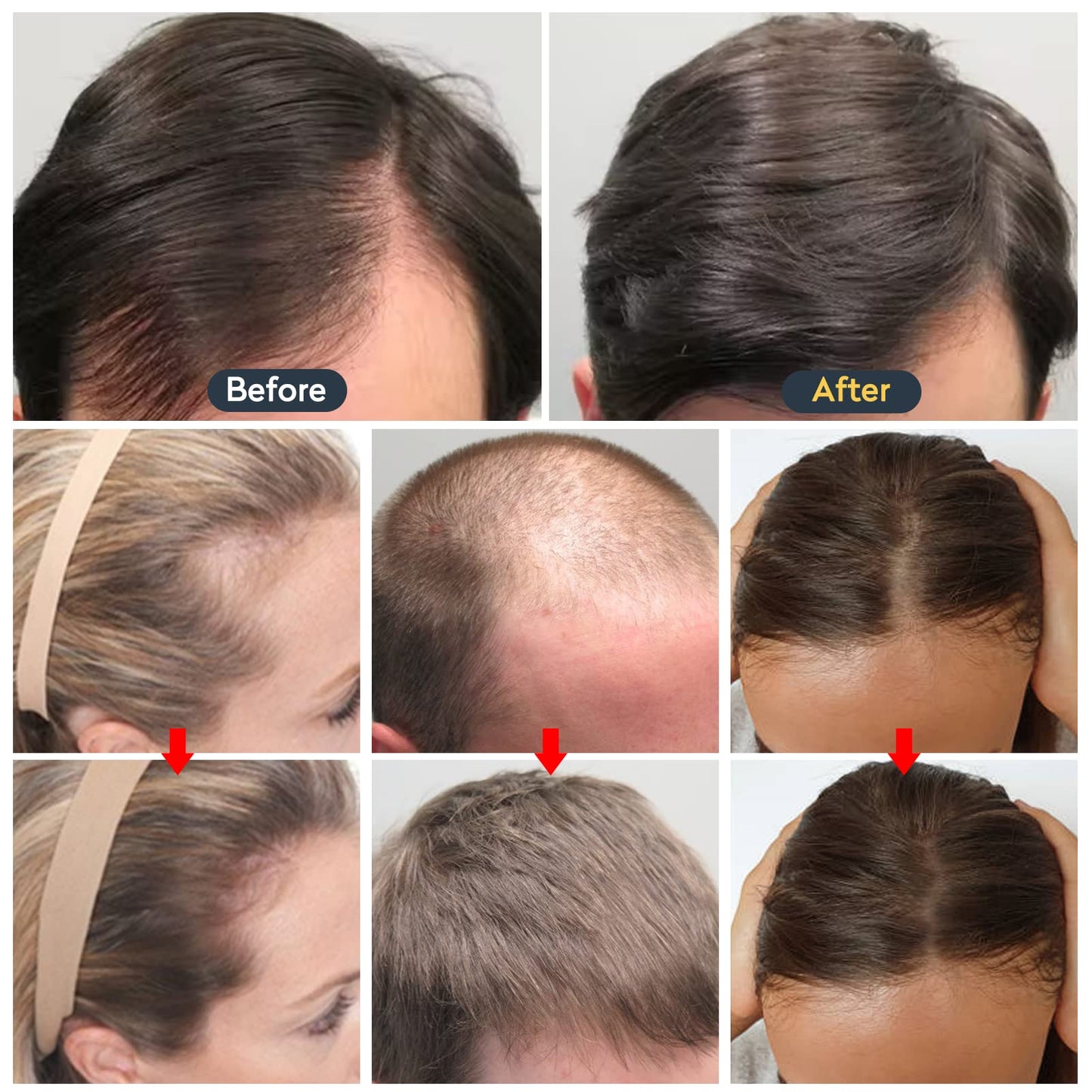 JAYSUING™ Hair Growth Oil Fast Hair Growth Effective Treatment