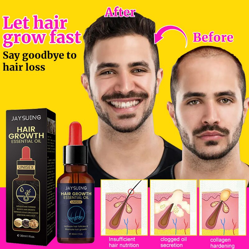 JAYSUING™ Hair Growth Oil Fast Hair Growth Effective Treatment