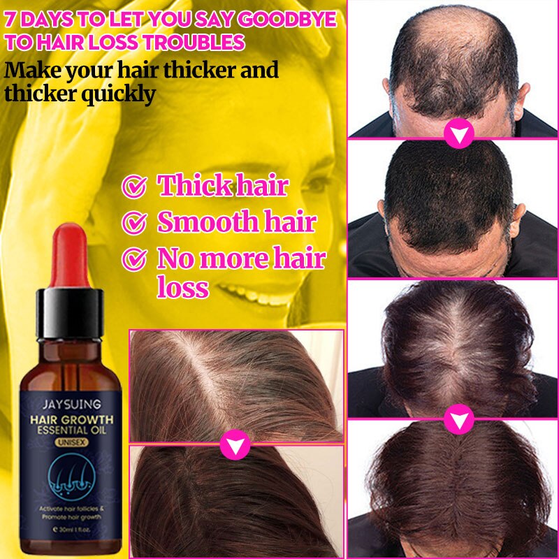JAYSUING™ Hair Growth Oil Fast Hair Growth Effective Treatment