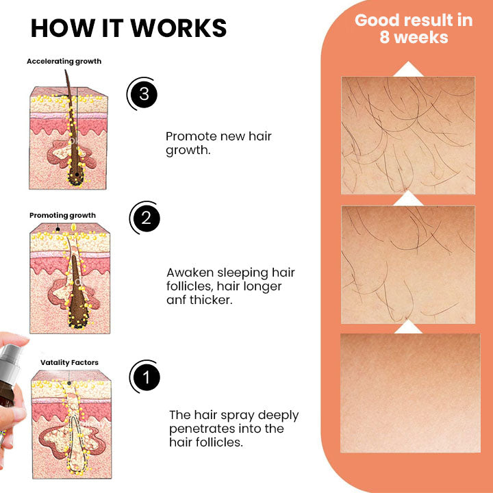 Oveallgo™ Ashwagandha 4500 Ultimate Hair Growth Spray