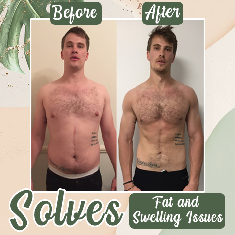 Perfect Detox Slimming Patch(Limited Time Discount đ„ Last Day)