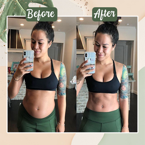 Perfect Detox Slimming Patch(Limited Time Discount đ„ Last Day)