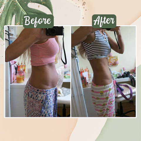 Perfect Detox Slimming Patch(Limited Time Discount đ„ Last Day)