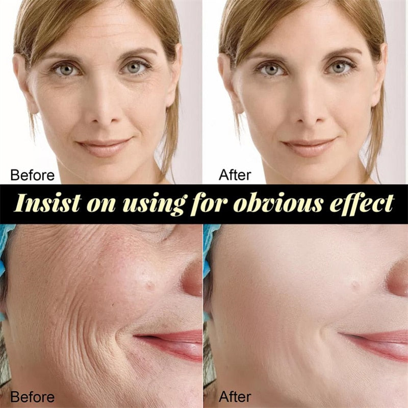 Absorbable Anti-Aging Facial Serum Collagen Wrinkle Remove