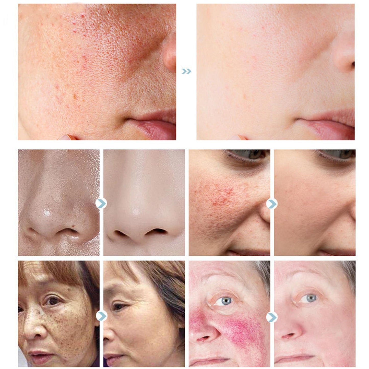 Pore Shrinking Serum Salicylic Anti Aging Whitening 30ml