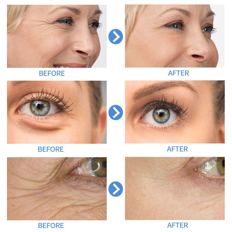 Retinol Anti Aging Remove Wrinkle Serum Lifting Brighten 30ml