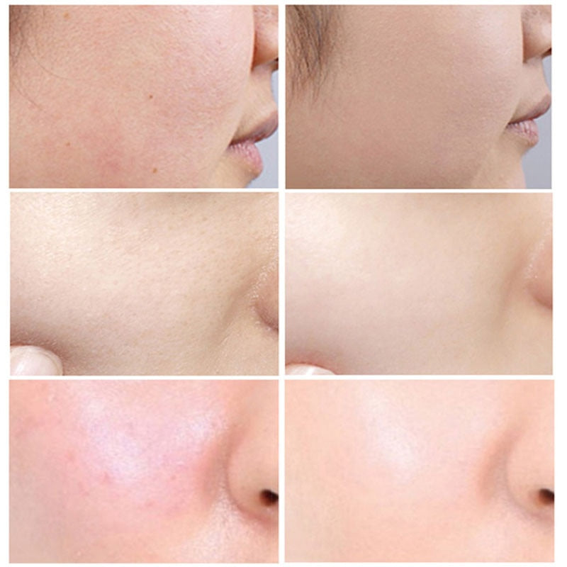 Pore Shrinking Serum Salicylic Anti Aging Whitening 30ml