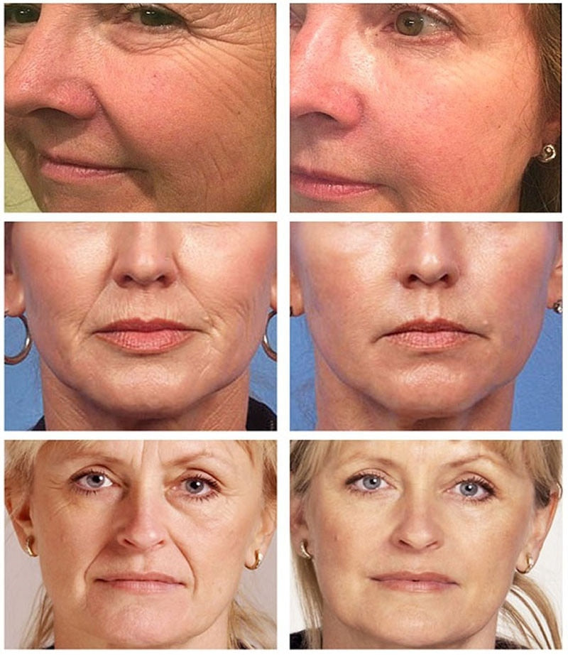 Retinol Anti Aging Remove Wrinkle Serum Lifting Brighten 30ml