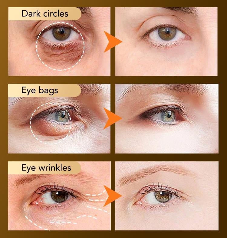 Snake Venom Peptide Anti-Wrinkle Eye Cream🔥BUY 1 GET 1 FREE🔥