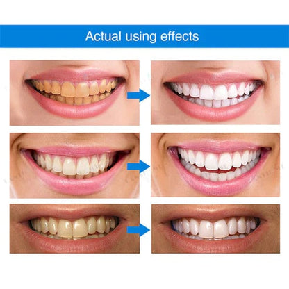 🔥Last Day Promotion 50% OFF🔥-Teeth Whitening Essence