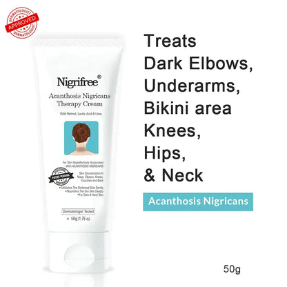 Nigrifree® Acanthosis Nigricans Therapy Cream - - 10% Lactic Acid + 0.1% Retinol