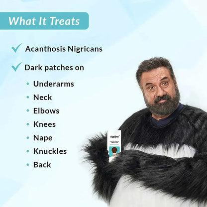 Nigrifree® Acanthosis Nigricans Therapy Cream - - 10% Lactic Acid + 0.1% Retinol