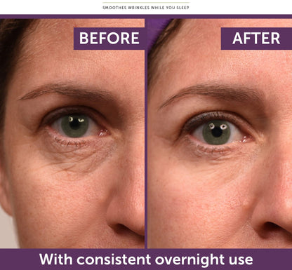 Snake Venom Peptide Anti-Wrinkle Eye Cream🔥BUY 1 GET 1 FREE🔥
