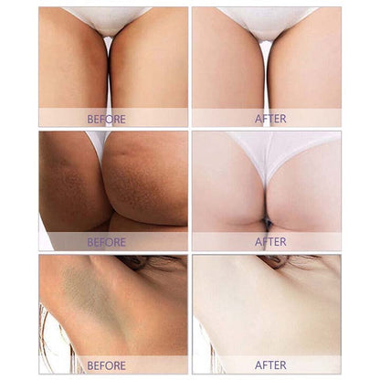 BioLap™ Dark Spot Correcting Cream