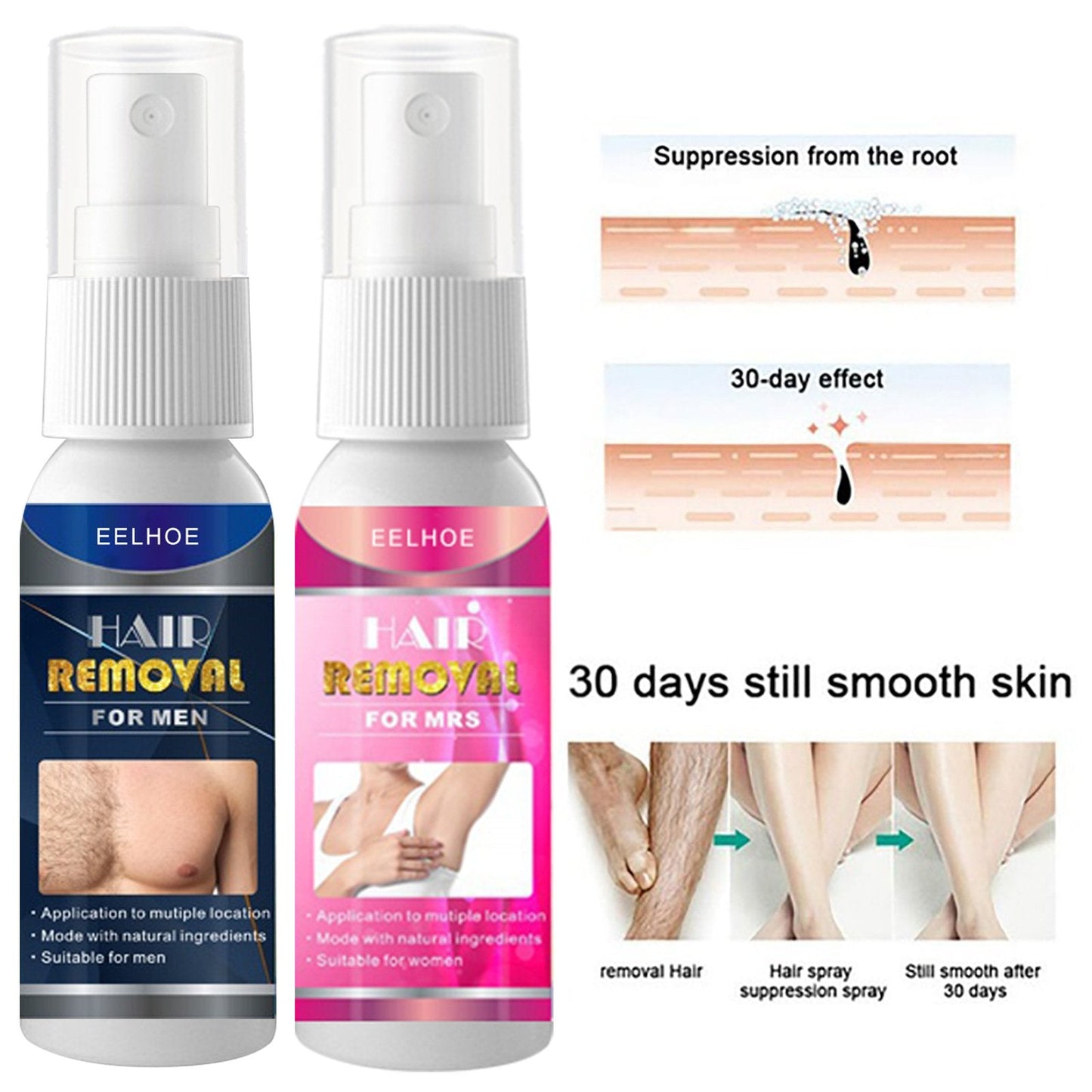 2023 New EELHOE® Semi-Permanent Hair Removal Spray 30ml
