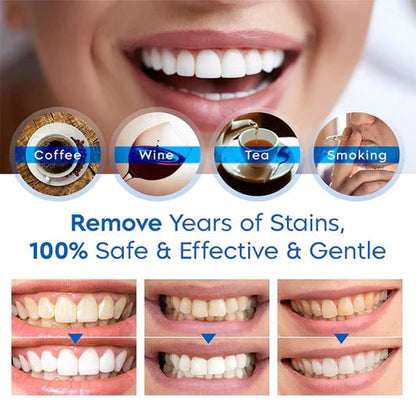 🔥Last Day Promotion 50% OFF🔥-Teeth Whitening Essence