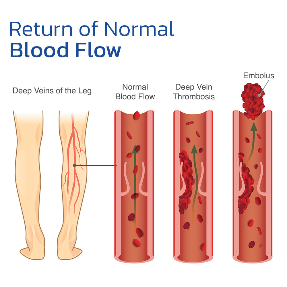 FixVein Varicose Treatment Spray