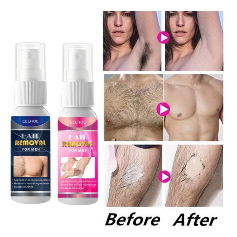2023 New EELHOE® Semi-Permanent Hair Removal Spray 30ml