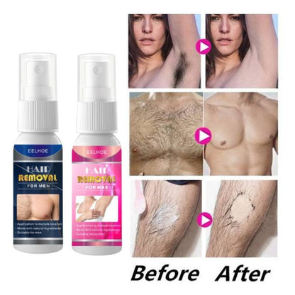 2023 New EELHOE® Semi-Permanent Hair Removal Spray 30ml