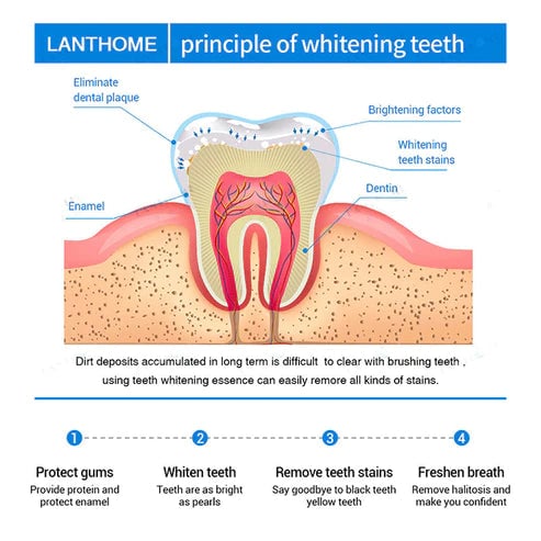 🔥Last Day Promotion 50% OFF🔥-Teeth Whitening Essence