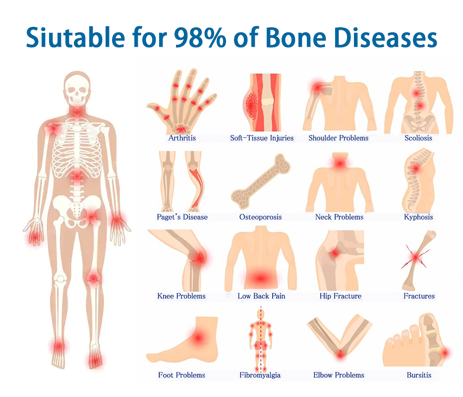 EELHOE™  Anti-Inflammatory & Joint & Bone Therapy Cream