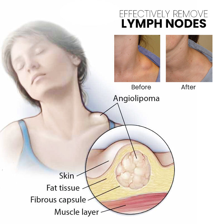 Anti-Swelling Lymphatic Detox Ointment
