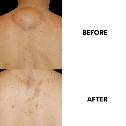 Anti-Swelling Lymphatic Detox Ointment