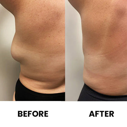 Anti-Swelling Lymphatic Detox Ointment