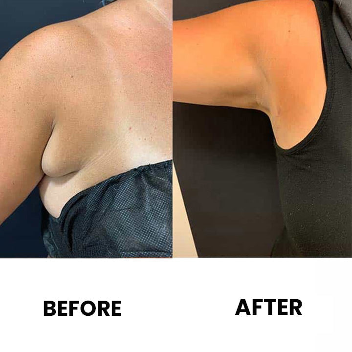 Anti-Swelling Lymphatic Detox Ointment