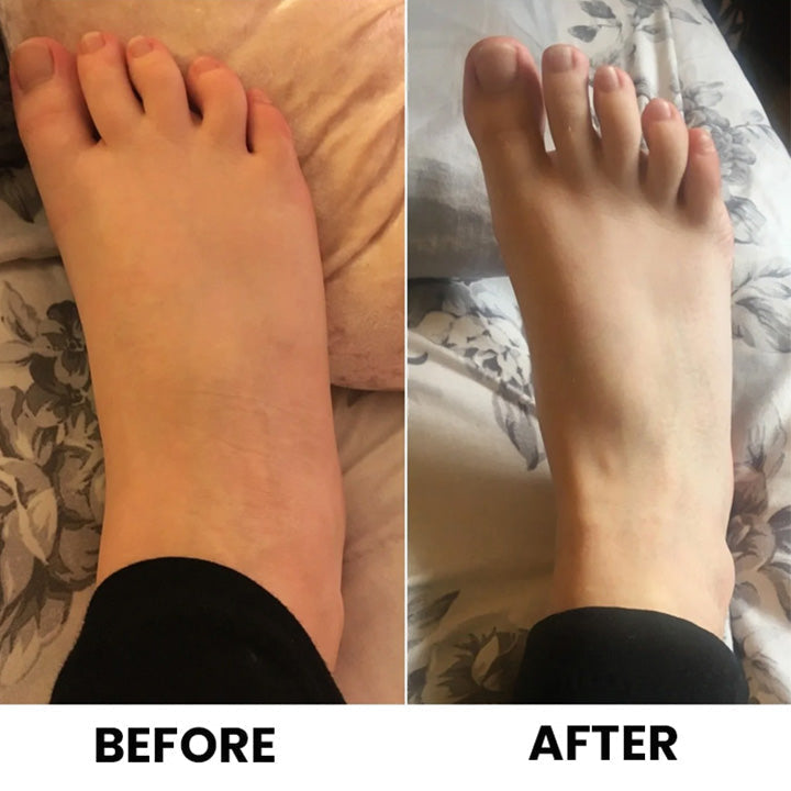 Anti-Swelling Lymphatic Detox Ointment