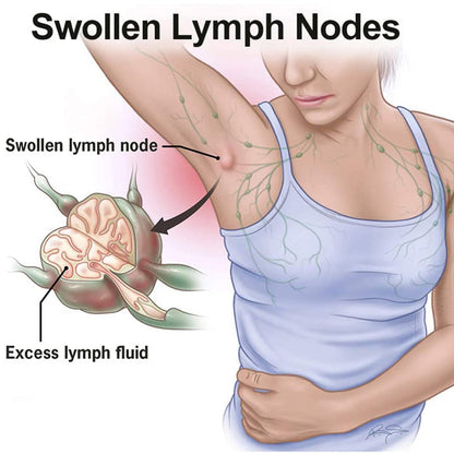 Lymph Nodes Herbal Detox Cream