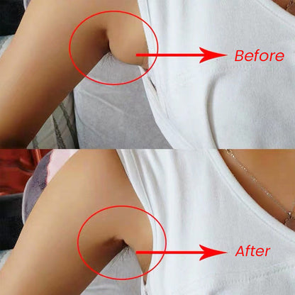 Lymph Nodes Herbal Detox Cream
