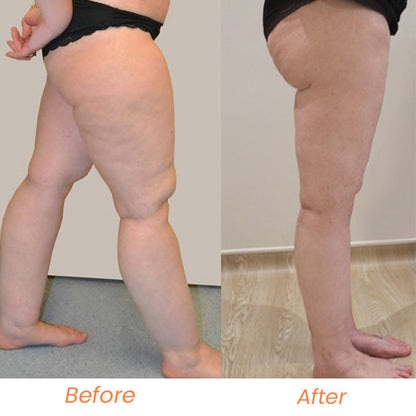 Lymph Nodes Herbal Detox Cream