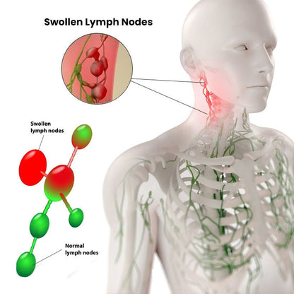 Lymph Nodes Herbal Detox Patch