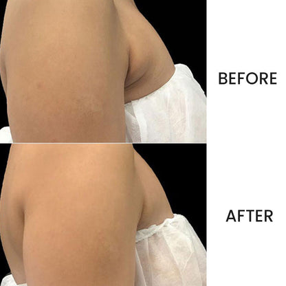 Lymph Nodes Herbal Detox Patch