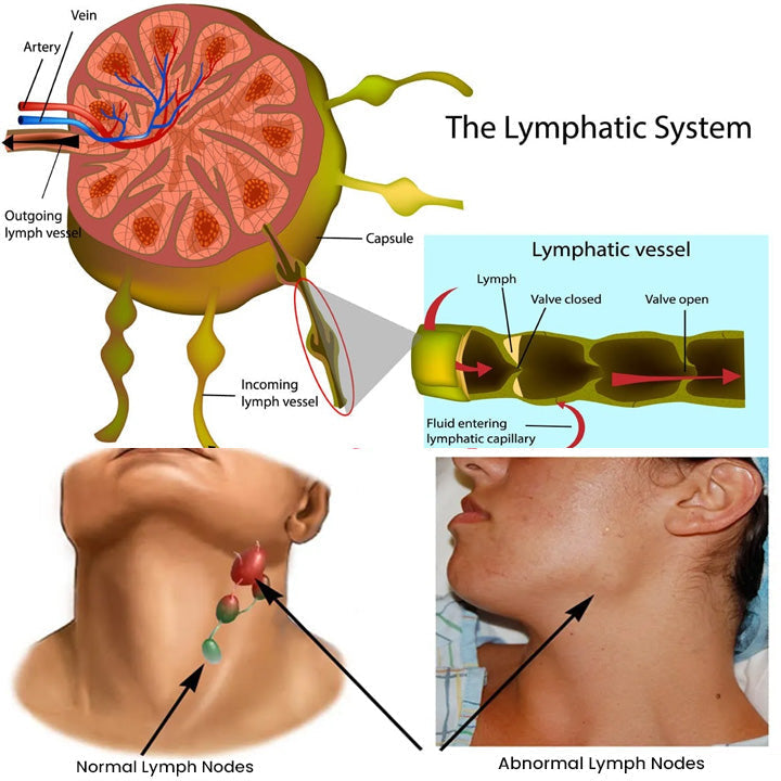 Anti-Swelling Lymphatic Detox Ointment