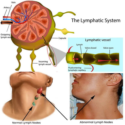 Anti-Swelling Lymphatic Detox Ointment