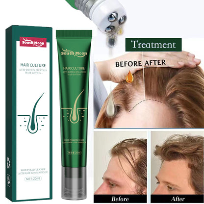 South Moon™ 2023 Biotin Fast Hair Growth Oil Unisex