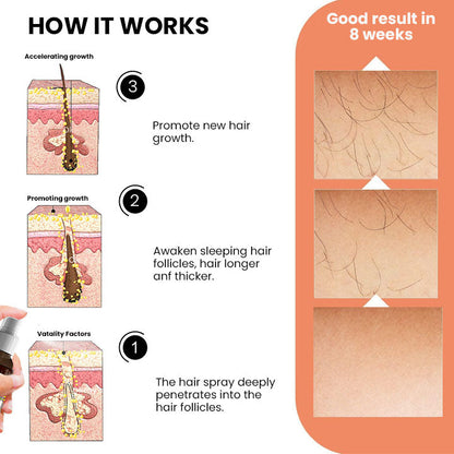 Oveallgo™ Ashwagandha 4500 Ultimate Hair Growth Spray