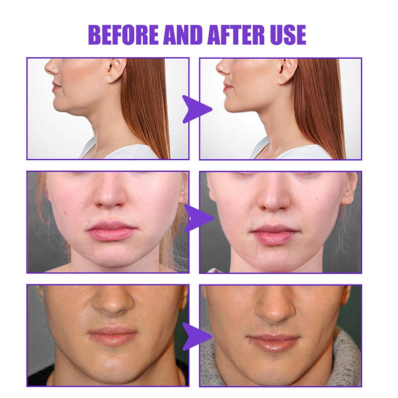 Firming Face-lift Cream V-Shape Anti-aging