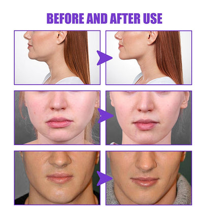 Firming Face-lift Cream V-Shape Anti-aging